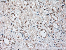 m00102 3 anti il6 mouse monoclonal antibody clone id oti3g9 ihc testing 16