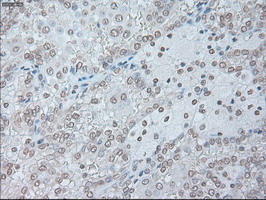 m00102 3 anti il6 mouse monoclonal antibody clone id oti3g9 ihc testing 17