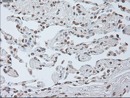m00102 3 anti il6 mouse monoclonal antibody clone id oti3g9 ihc testing 18