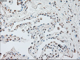 m00102 3 anti il6 mouse monoclonal antibody clone id oti3g9 ihc testing 3
