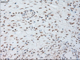 m00102 3 anti il6 mouse monoclonal antibody clone id oti3g9 ihc testing 4