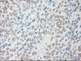 m00102 3 anti il6 mouse monoclonal antibody clone id oti3g9 ihc testing 5