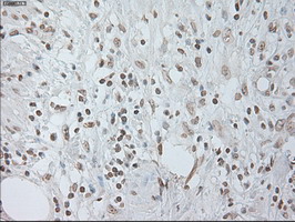 m00102 3 anti il6 mouse monoclonal antibody clone id oti3g9 ihc testing 7