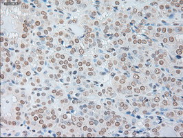 m00102 3 anti il6 mouse monoclonal antibody clone id oti3g9 ihc testing 8