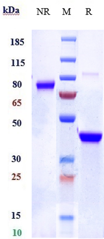 Anti-IL-6Ra/CD126 Reference Antibody (vobarilizumab) on SDS-PAGE under reducing (R) condition