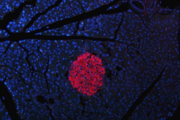 m00104 1 erk12 primary antibodies if testing 12