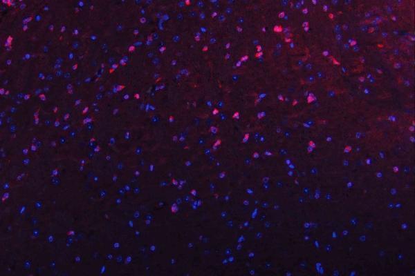 m00104 1 erk12 primary antibodies if testing 13