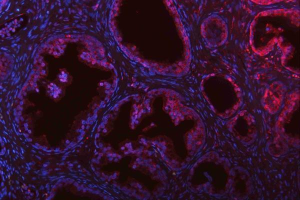 m00104 1 erk12 primary antibodies if testing 14_1