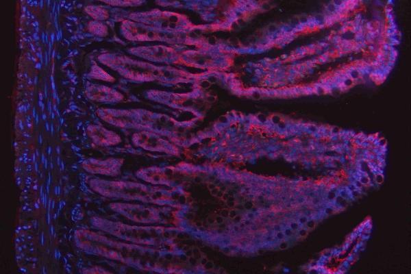 m00104 1 erk12 primary antibodies if testing 16