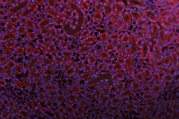 m00104 1 erk12 primary antibodies if testing 17