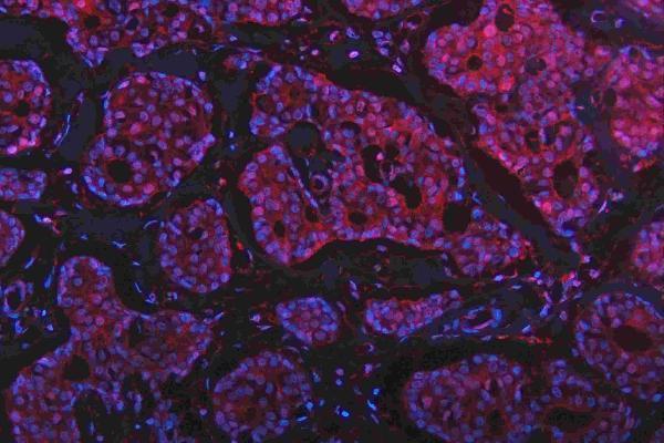 m00104 1 erk12 primary antibodies if testing 18