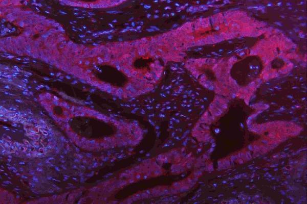 m00104 1 erk12 primary antibodies if testing 19