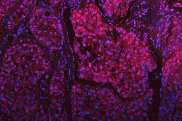 m00104 1 erk12 primary antibodies if testing 20