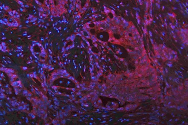 m00104 1 erk12 primary antibodies if testing 21_1