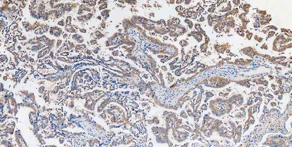 m00104 1 erk12 primary antibodies ihc testing 11