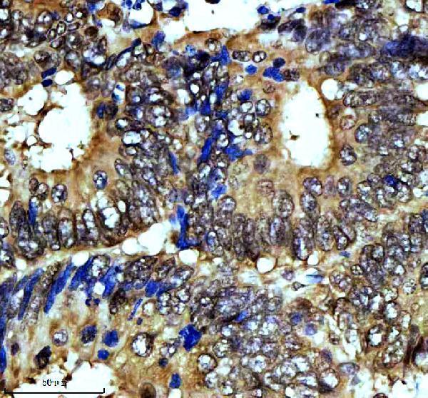IHC analysis of ERK1 using anti-ERK1 antibody (M00104)