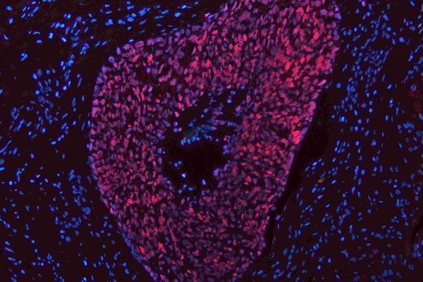m00105 1 sox2 primary antibodies if testing 6