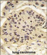m00105 3 anti sox2 antibody ihc p testing 7