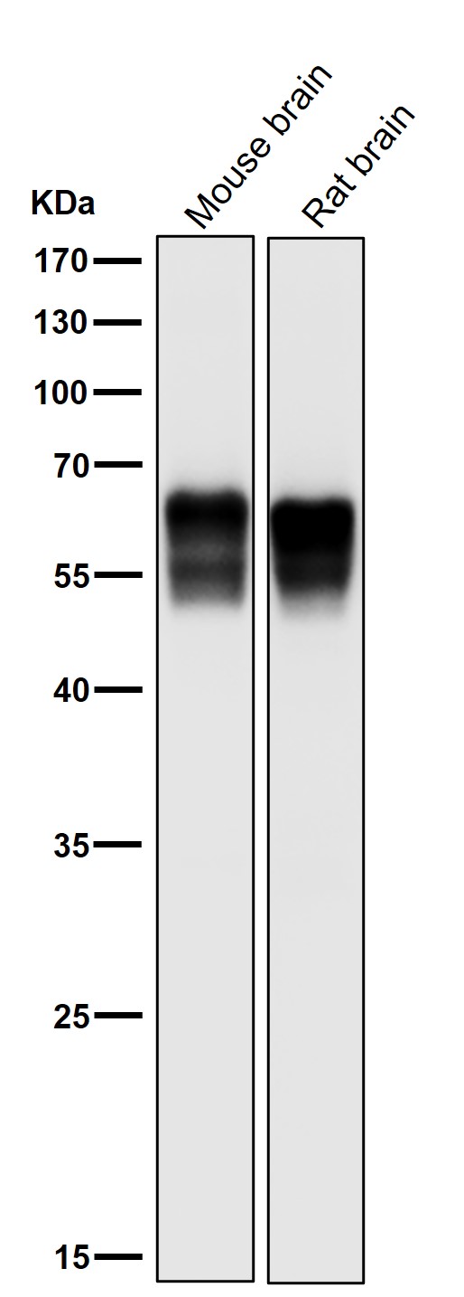 All lanes use the Antibody at 1:1K dilution for 1 hour at room temperature