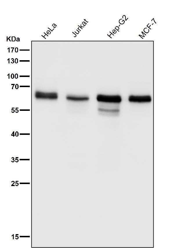 All lanes use the Antibody at 1:1K dilution for 1 hour at room temperature