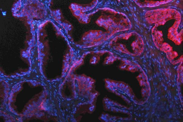 m00107 src primary antibodies if testing 7