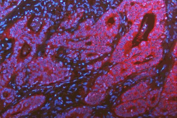 m00107 src primary antibodies if testing 8