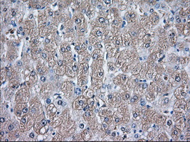 m00108 anti glucose 6 phosphate isomerase gpi mouse monoclonal antibody clone id oti5a11 ihc testing 5