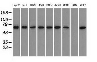 m00108 anti glucose 6 phosphate isomerase gpi mouse monoclonal antibody clone id oti5a11 wb testing 2