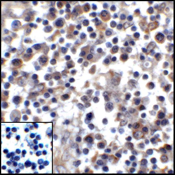 m00109 2 cd274 primary antibodies ihc testing 6