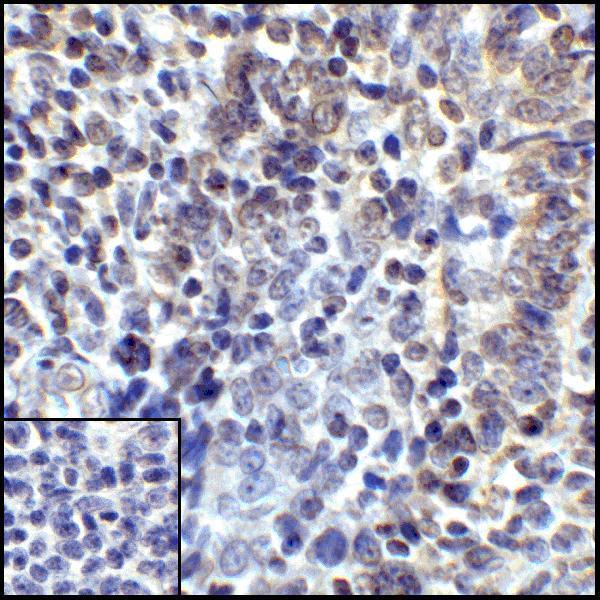 m00109 2 cd274 primary antibodies ihc testing 7