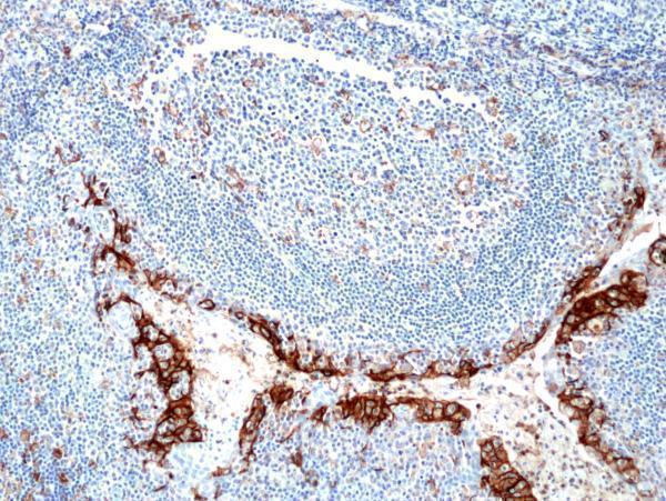Immunohistochemical staining of formalin fixed
and paraffin embedded human tonsil tissue section
using anti-PD-L1 rabbit monoclonal antibody (Clone
RM320) at a 1:250 dilution