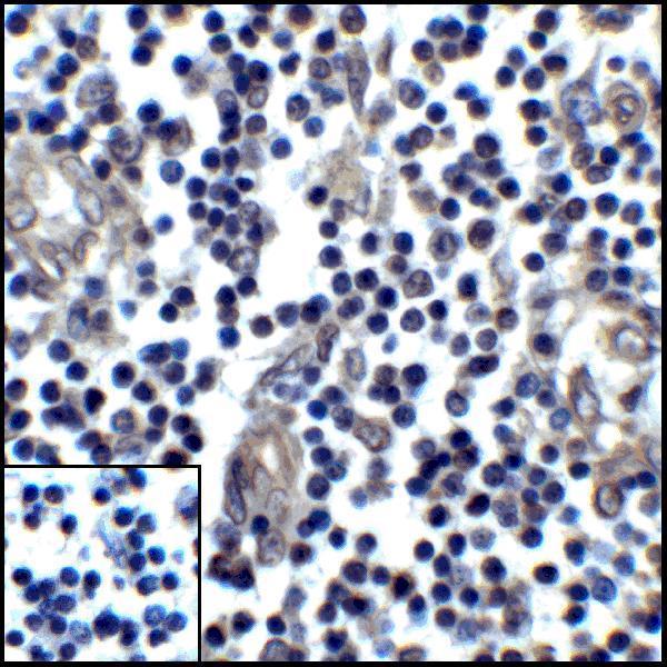 m00109 3 cd274 primary antibodies ihc testing 8