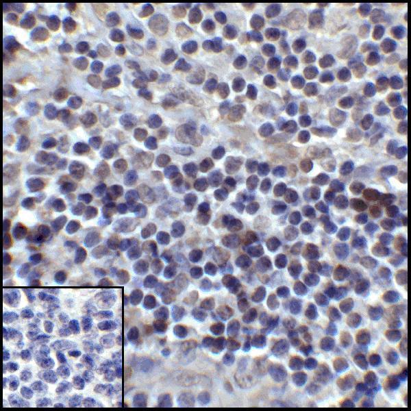 m00109 3 cd274 primary antibodies ihc testing 9