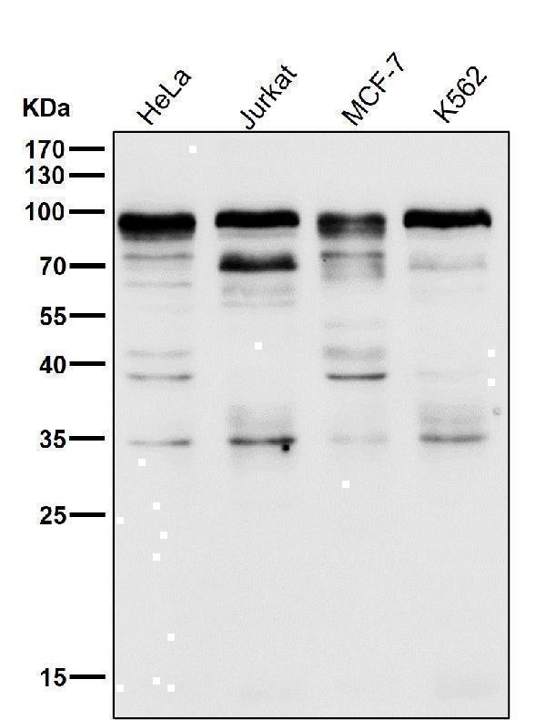 All lanes use the Antibody at 1:1K dilution for 1 hour at room temperature