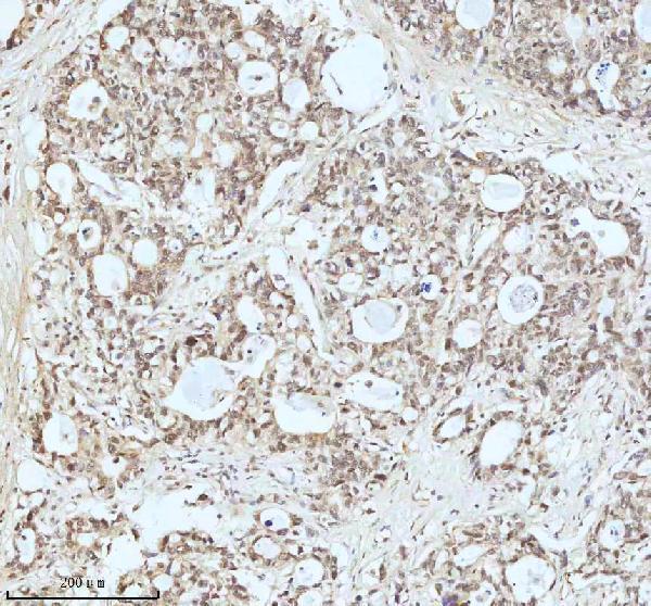  IHC analysis of Drosha using anti-Drosha antibody (M00111)