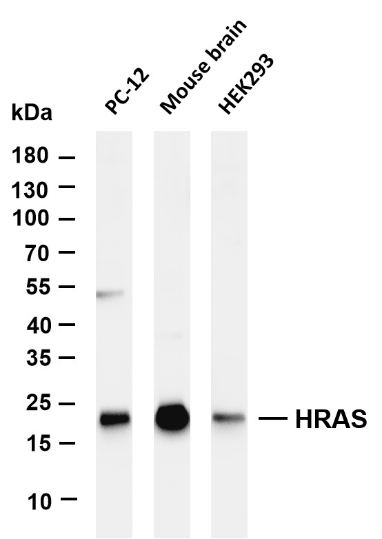 Various whole cell lysates were separated by 4-20% SDS-PAGE, and the membrane was blotted with anti-HRAS antibody