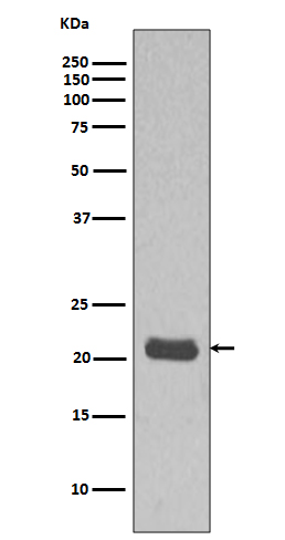 Western blot analysis MCF7 cell lysate using HRAS Antibody