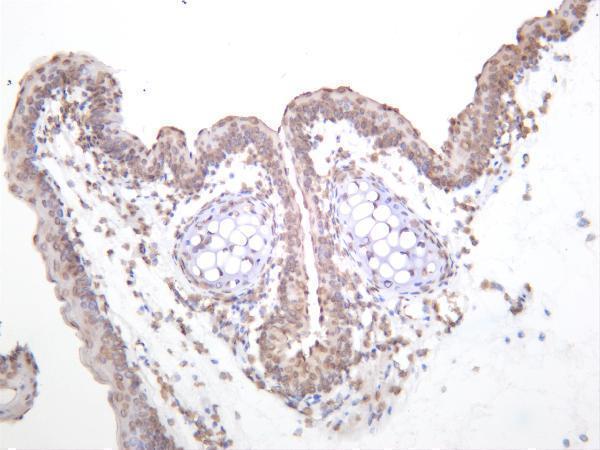 Mouse thyroid was stained with anti-YAP rabbit antibody