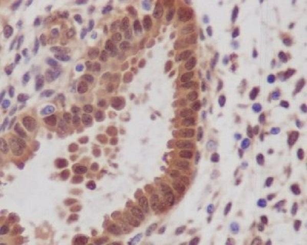 Immunohistochemical analysis of paraffin-embedded human uterus, using YAP1 Antibody