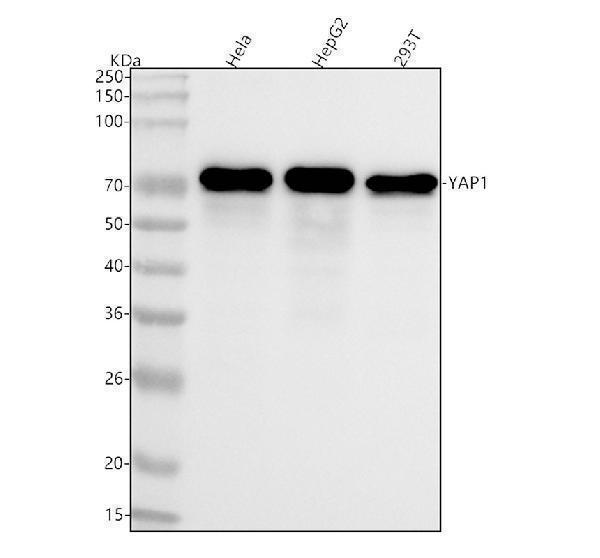  Western blot analysis of YAP1 using anti-YAP1 antibody (M00116)