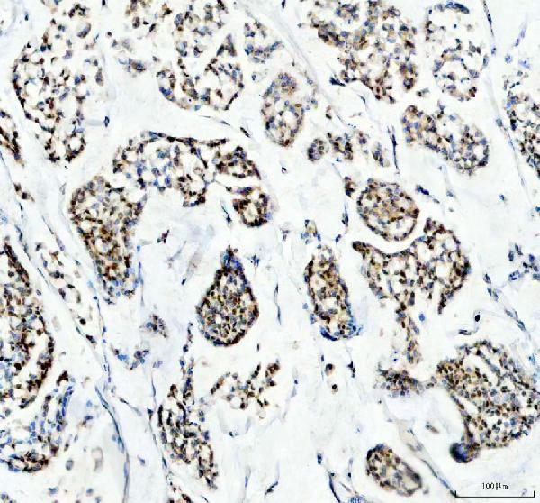 IHC analysis of EP300 using anti-EP300 antibody (M00117-1)