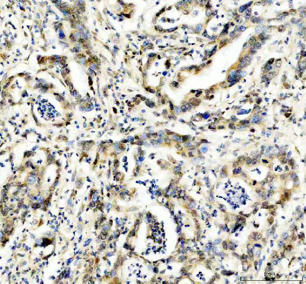 IHC analysis of EP300 using anti-EP300 antibody (M00117-1)