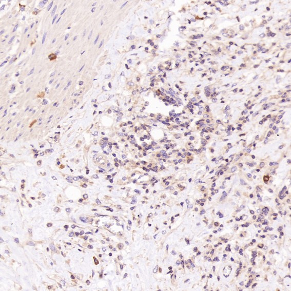 m00119 ihc10