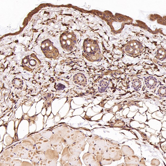 m00119 ihc12