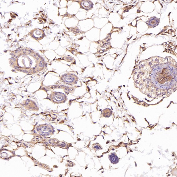 m00119 ihc7