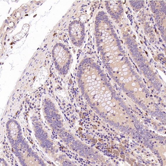 m00119 ihc9