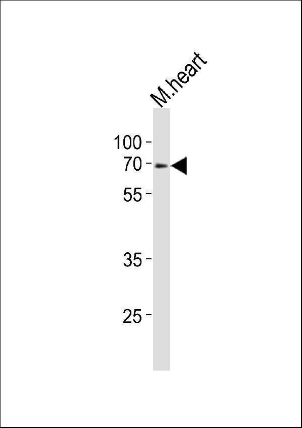 Western blot analysis of lysate from mouse heart tissue lysate, using Klf4 Antibody (Center)
