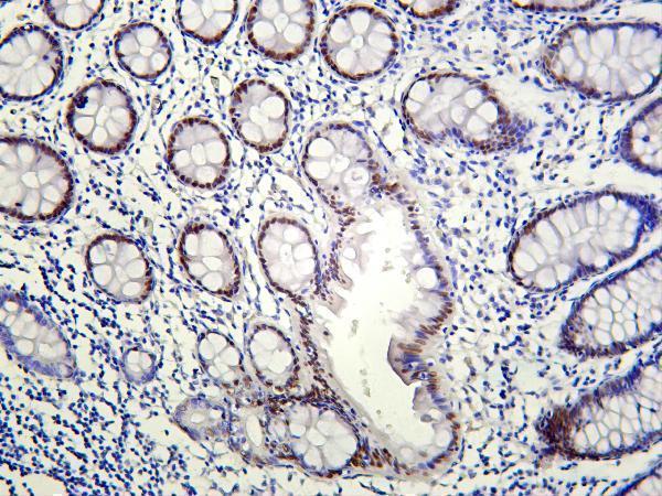 Human colon was stained with Anti-KLF4 rabbit antibody