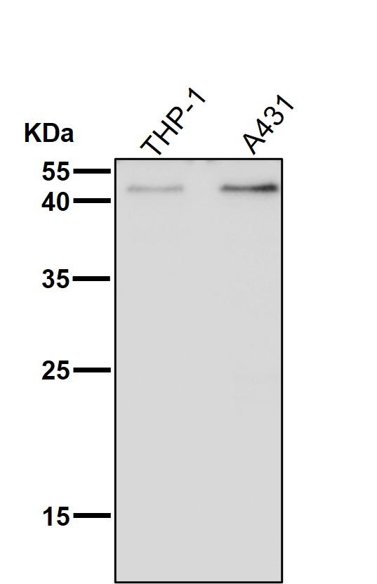 All lanes use the Antibody at 1:2K dilution for 1 hour at room temperature