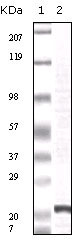 Western Blot analysis using FGF-2 Monoclonal Antibody against truncated FGF-2 recombinant protein